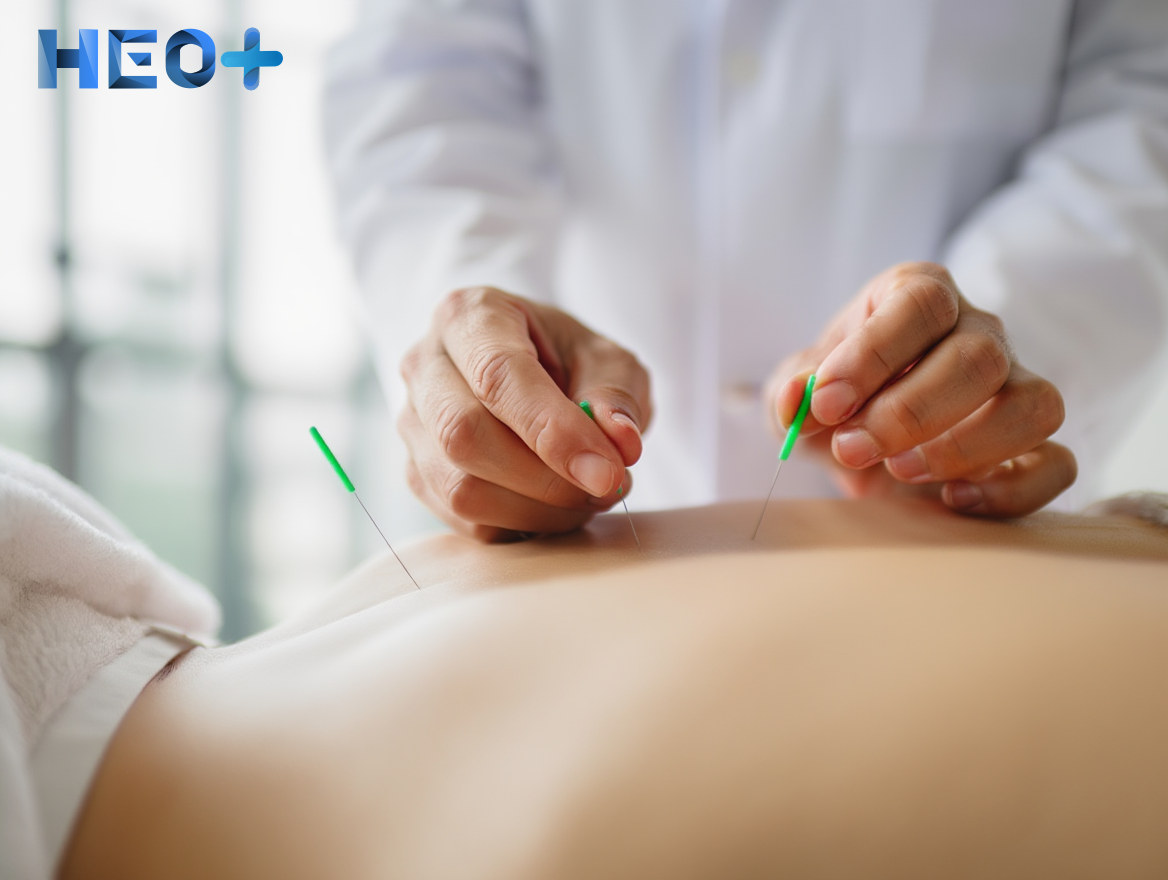 Врач кодирует пациента иглоукалыванием